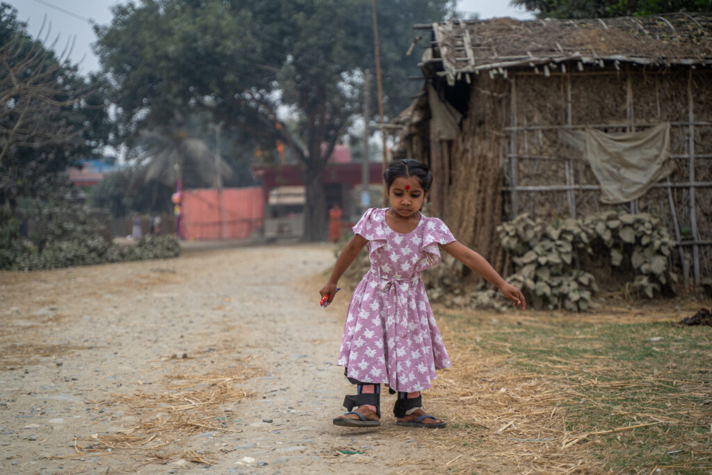 Child walking with support in leg